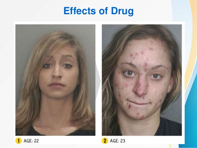 Effects of Drug