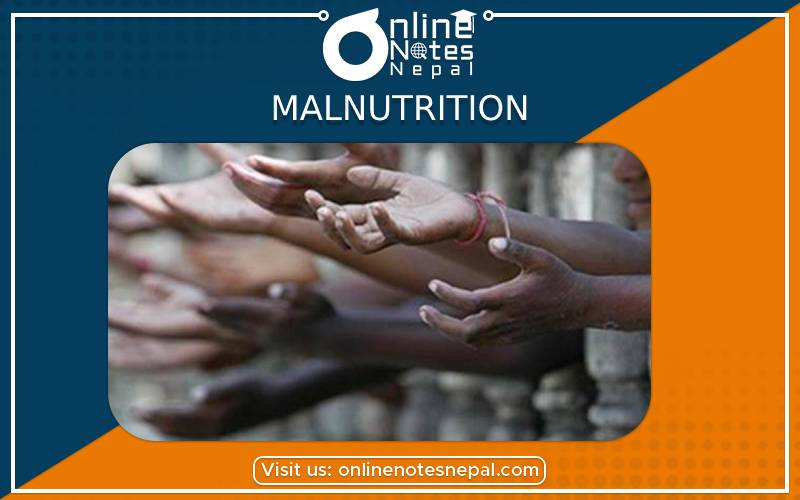 Malnutrition in Disease, Nutrition, Tobacco, Alcohol and Drugs